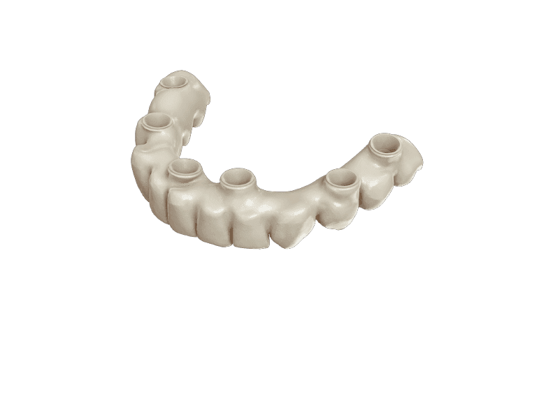 Full-Arch & All-on-X Restorations