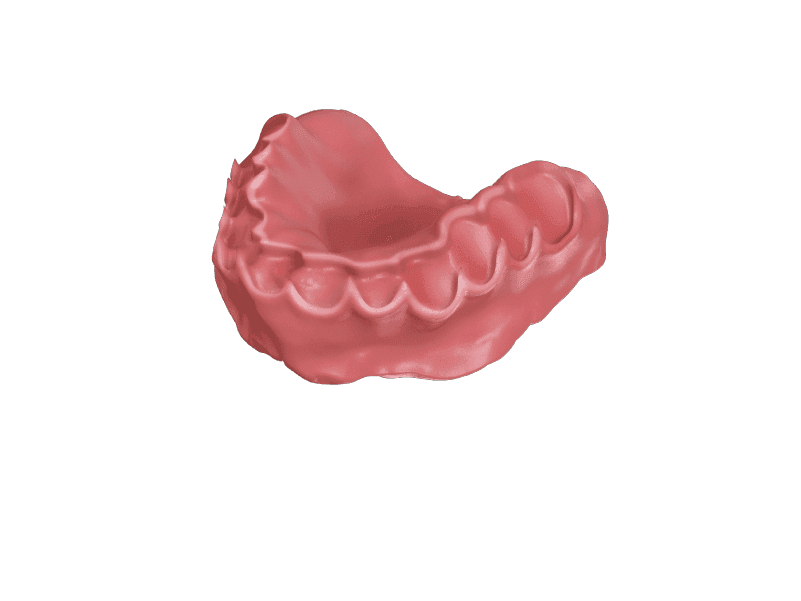 Digital Dentures