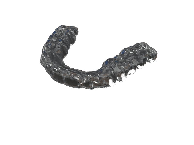 Occlusal Splints & Night Guards